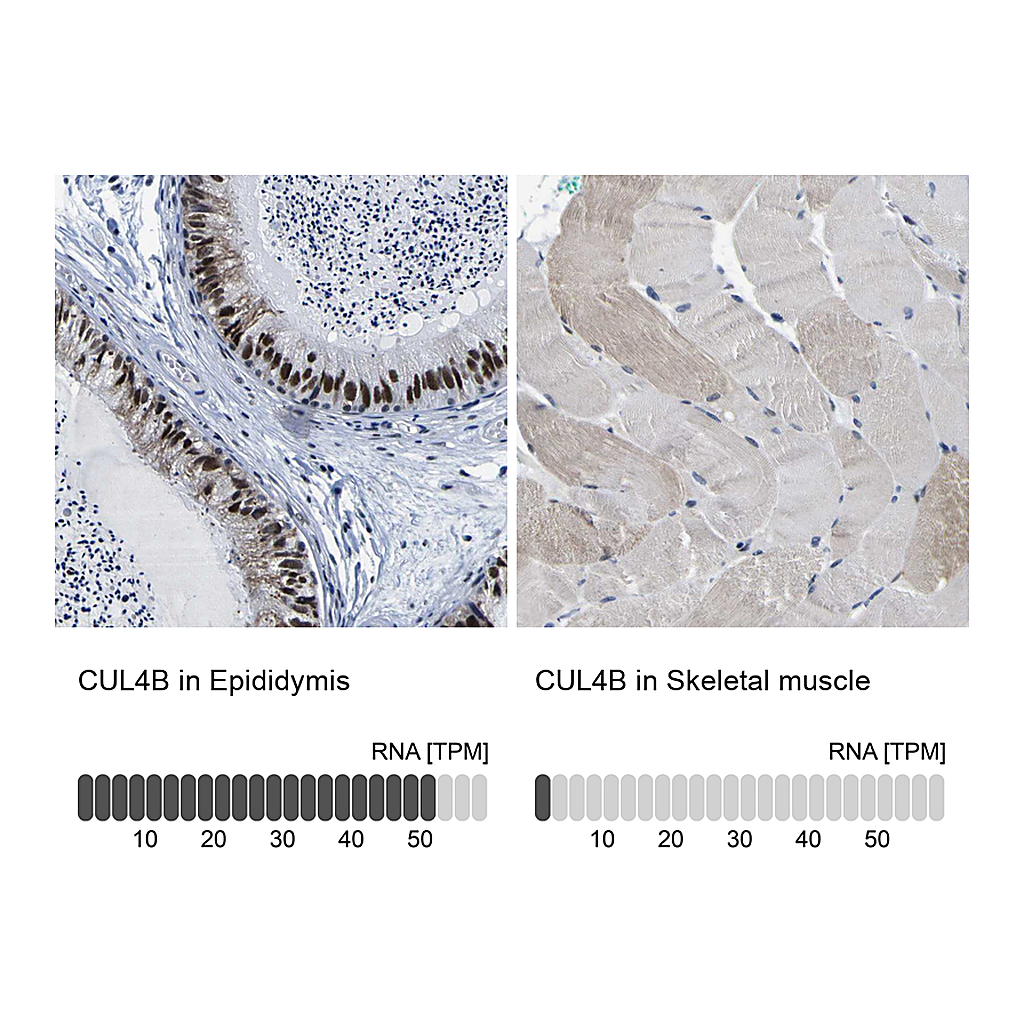 Atlas Antibodies Anti-CUL4B Antibody