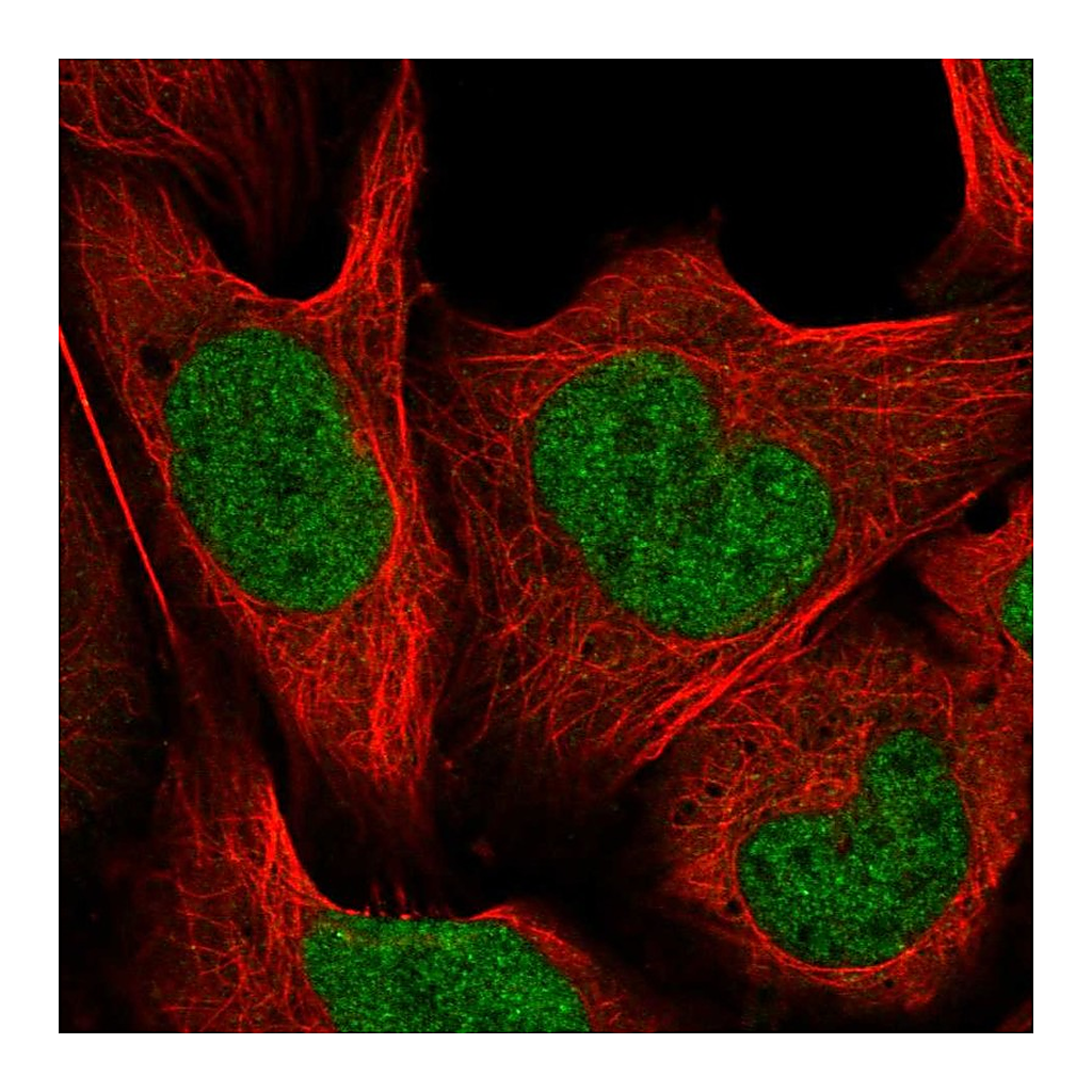 Atlas Antibodies Anti-CUL4B Antibody