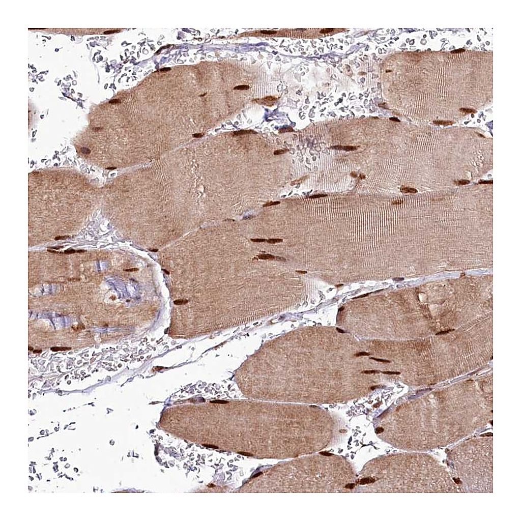 Atlas Antibodies Anti-CUTC Antibody