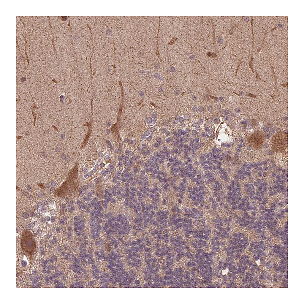 Atlas Antibodies Anti-CUTA Antibody