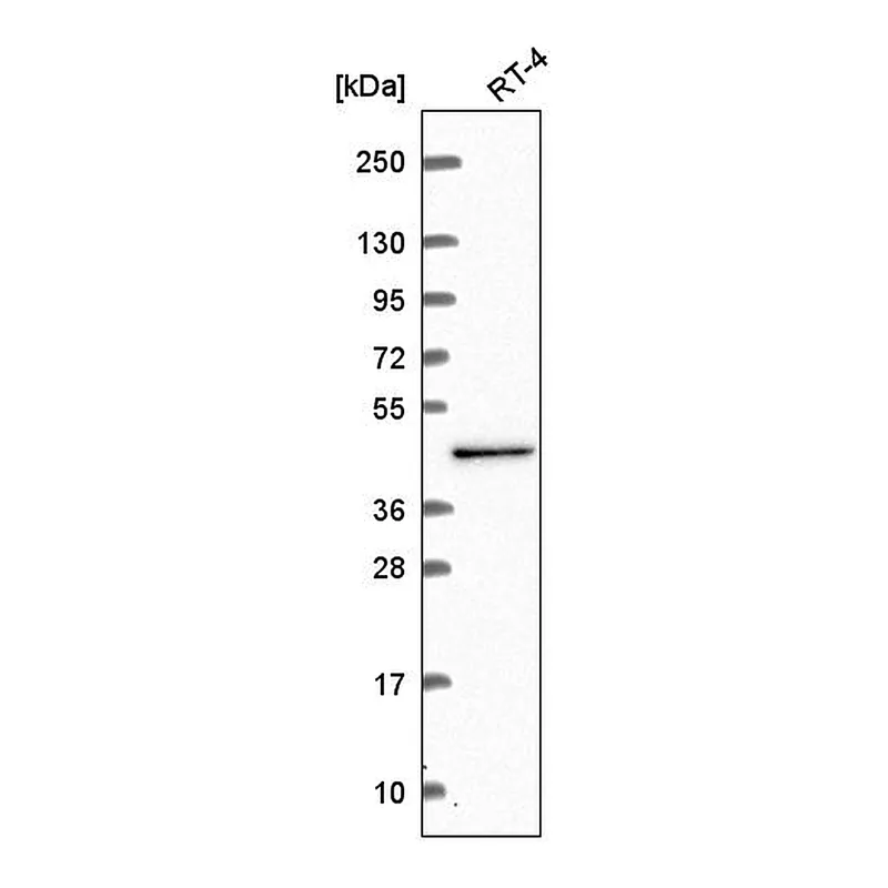 Atlas Antibodies Anti-CWC27 Antibody