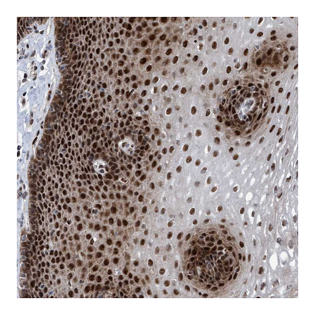 Atlas Antibodies Anti-CWC27 Antibody