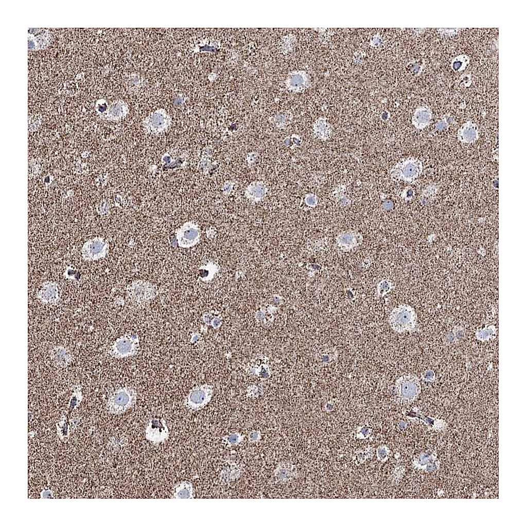 Atlas Antibodies Anti-CWF19L1 Antibody