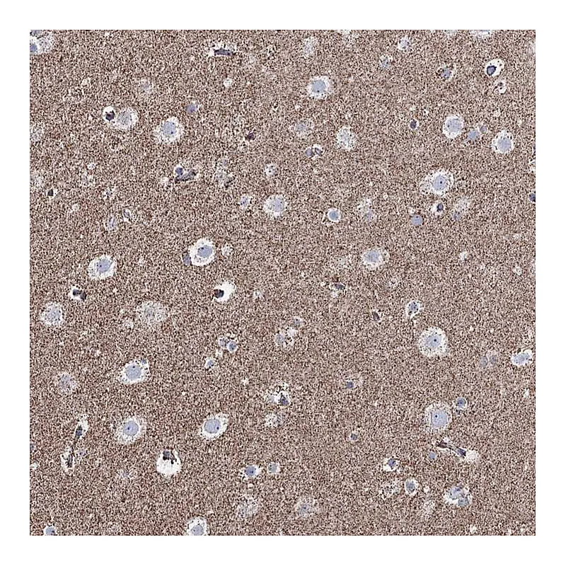 Atlas Antibodies Anti-CWF19L1 Antibody