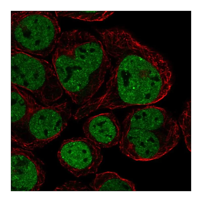 Atlas Antibodies Anti-CX3CR1 Antibody