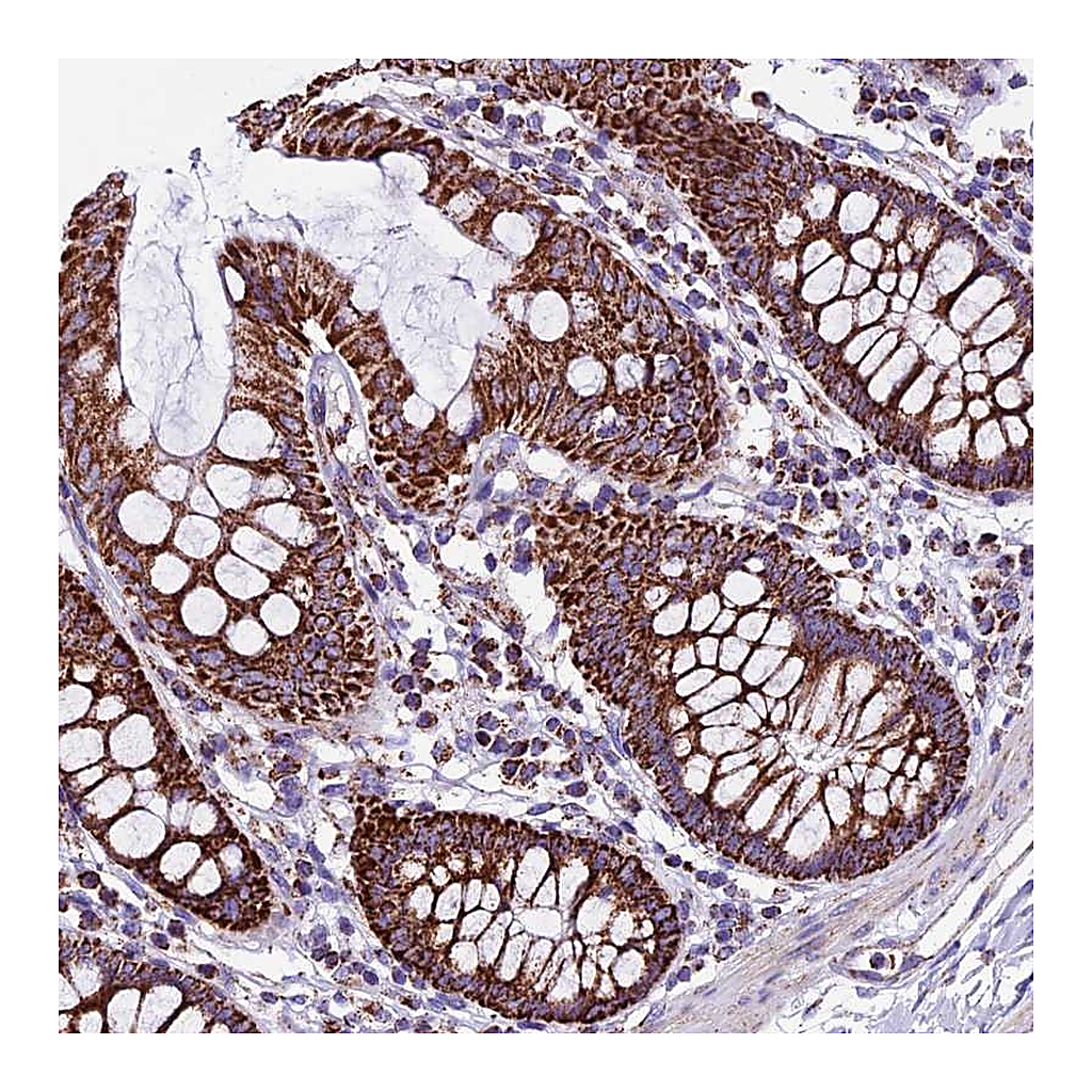 Atlas Antibodies Anti-CX3CL1 Antibody