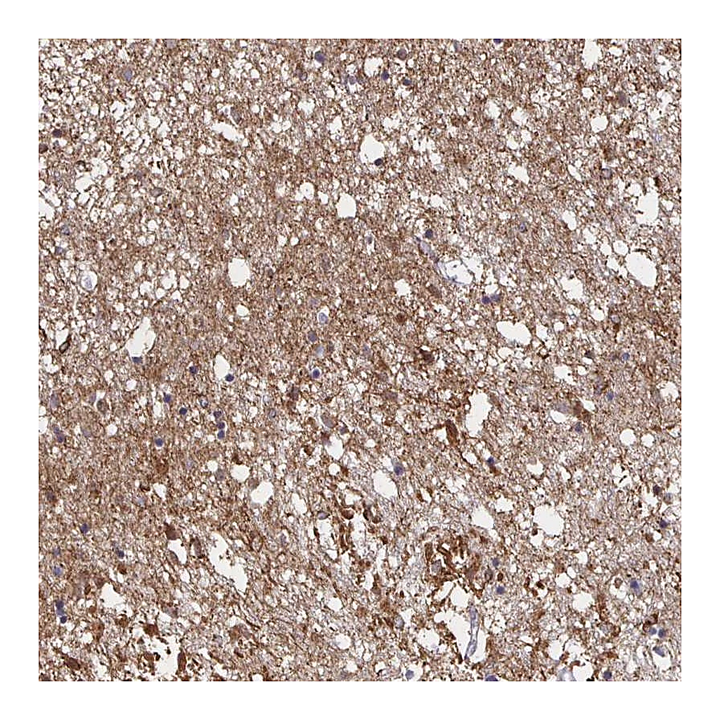 Atlas Antibodies Anti-CX3CR1 Antibody