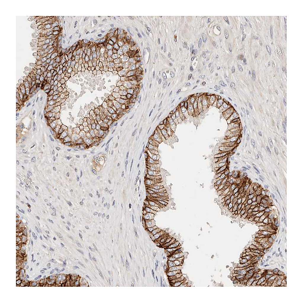 Atlas Antibodies Anti-CXADR Antibody