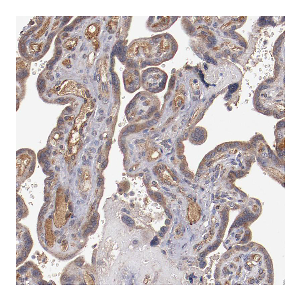 Atlas Antibodies Anti-CXorf36 Antibody