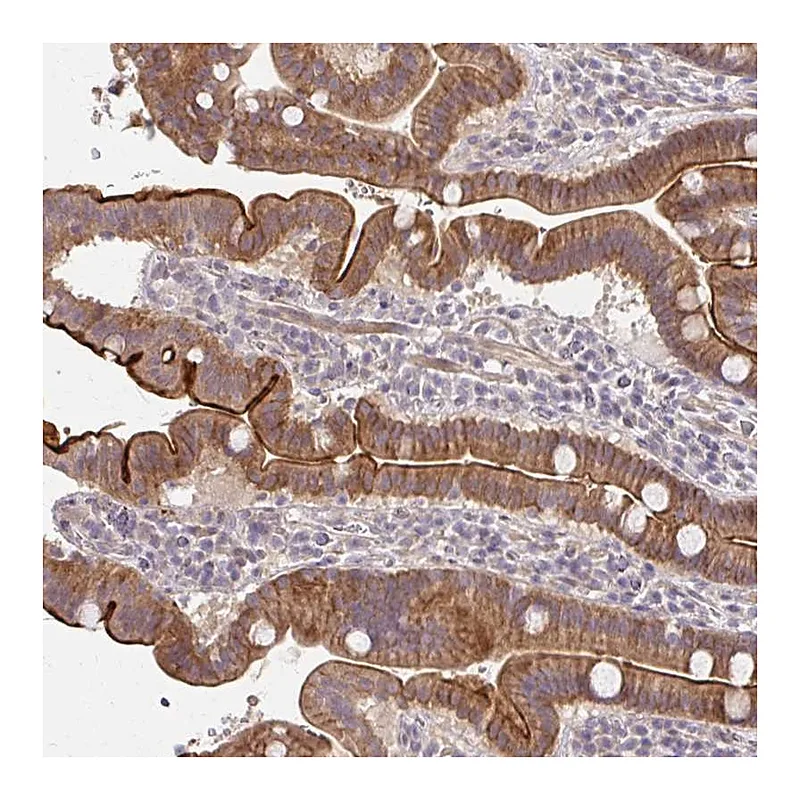 Atlas Antibodies Anti-CXorf40B Antibody