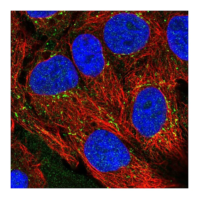Atlas Antibodies Anti-CXCL16 Antibody