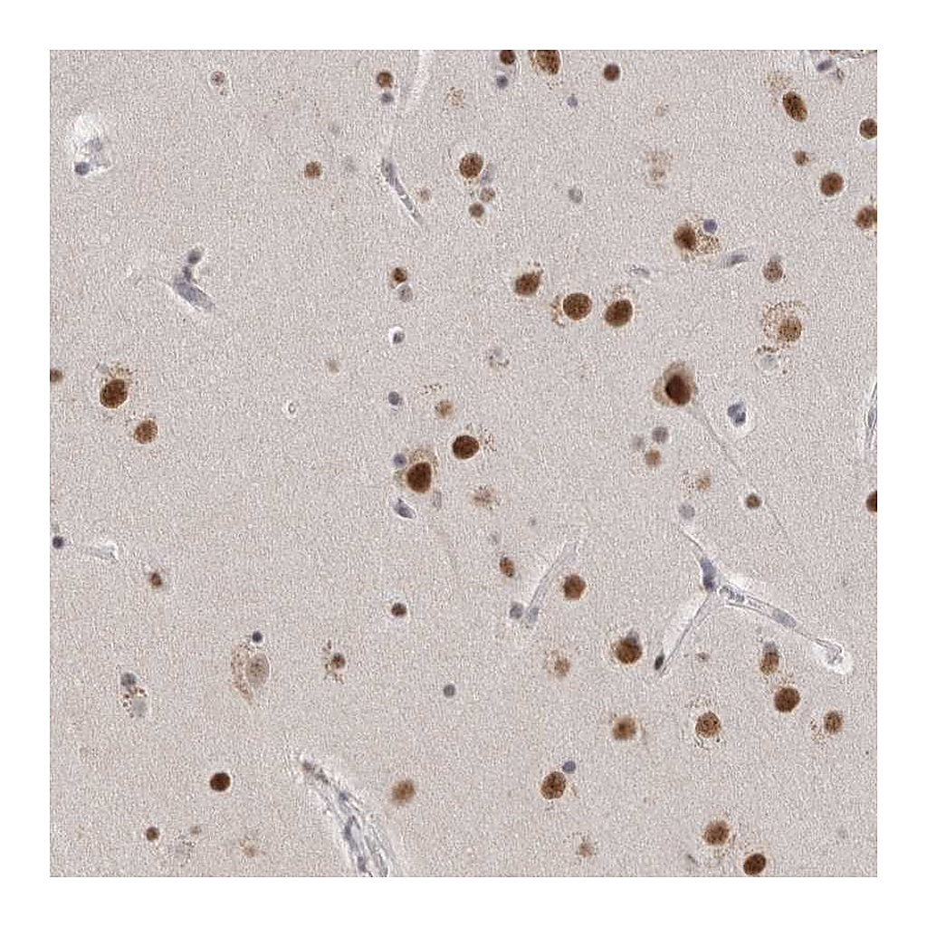 Atlas Antibodies Anti-CXorf23 Antibody