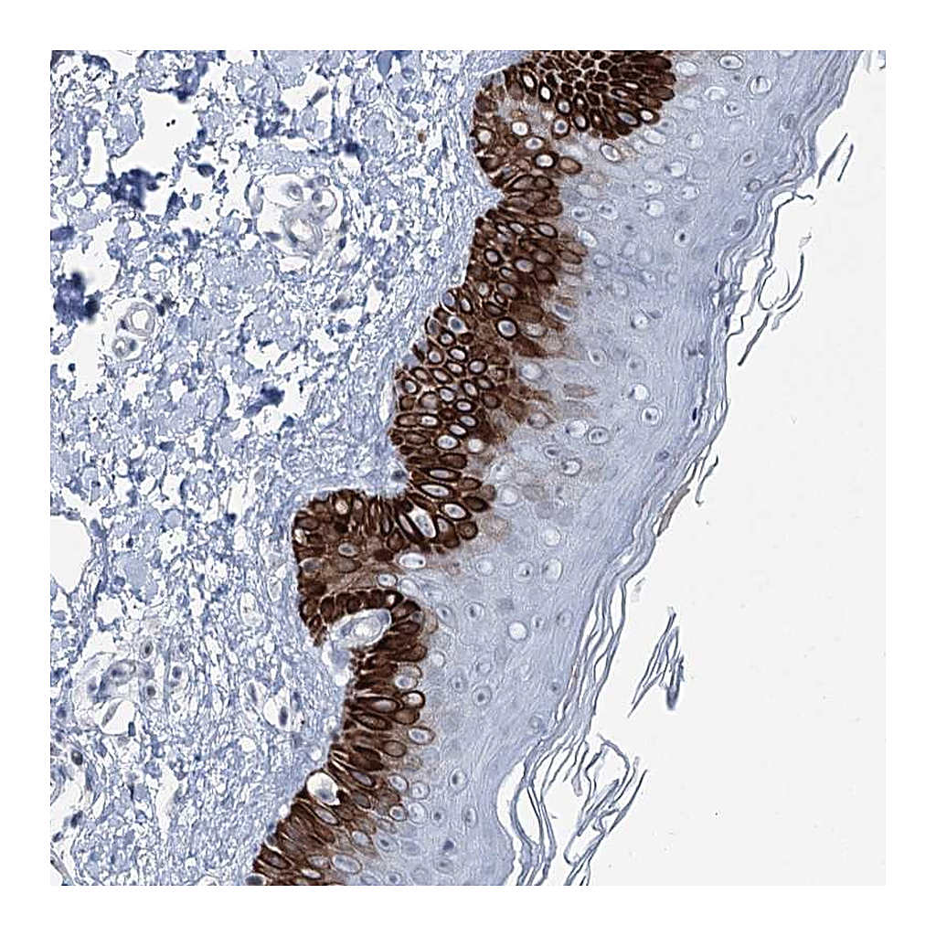 Atlas Antibodies Anti-CXorf56 Antibody