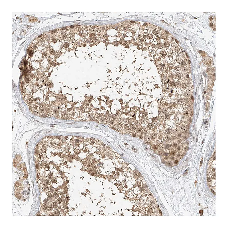 Atlas Antibodies Anti-CXorf58 Antibody