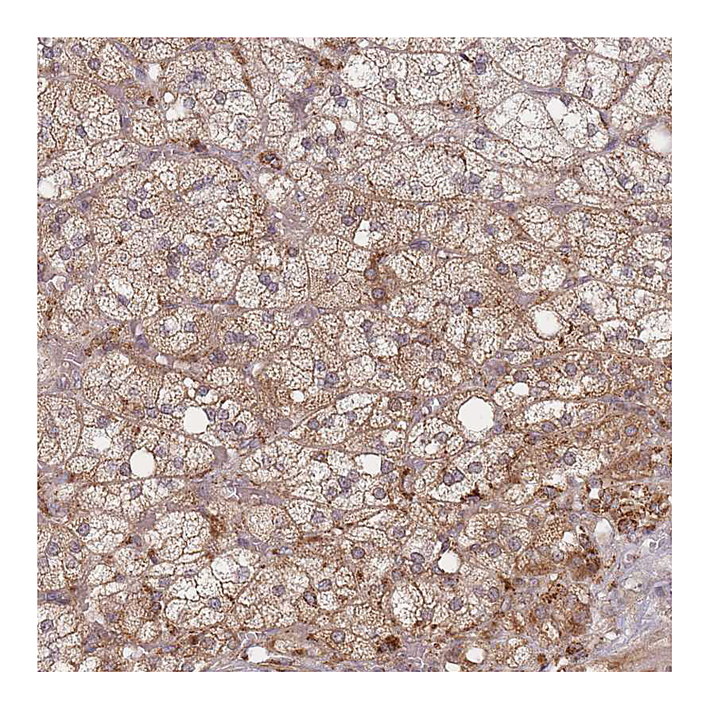 Atlas Antibodies Anti-CXorf57 Antibody