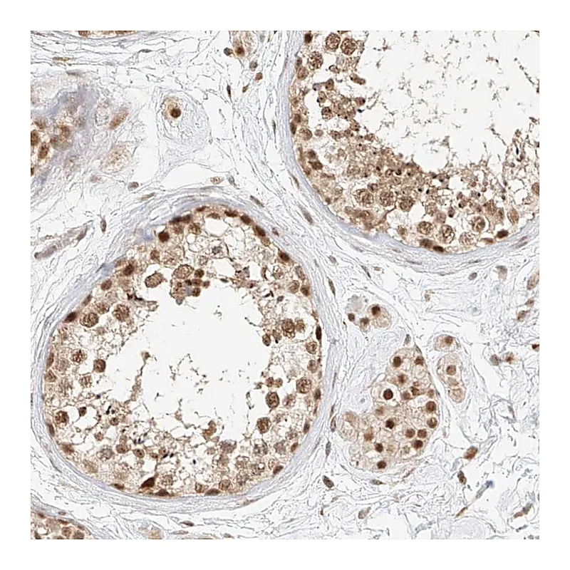 Atlas Antibodies Anti-CXorf58 Antibody