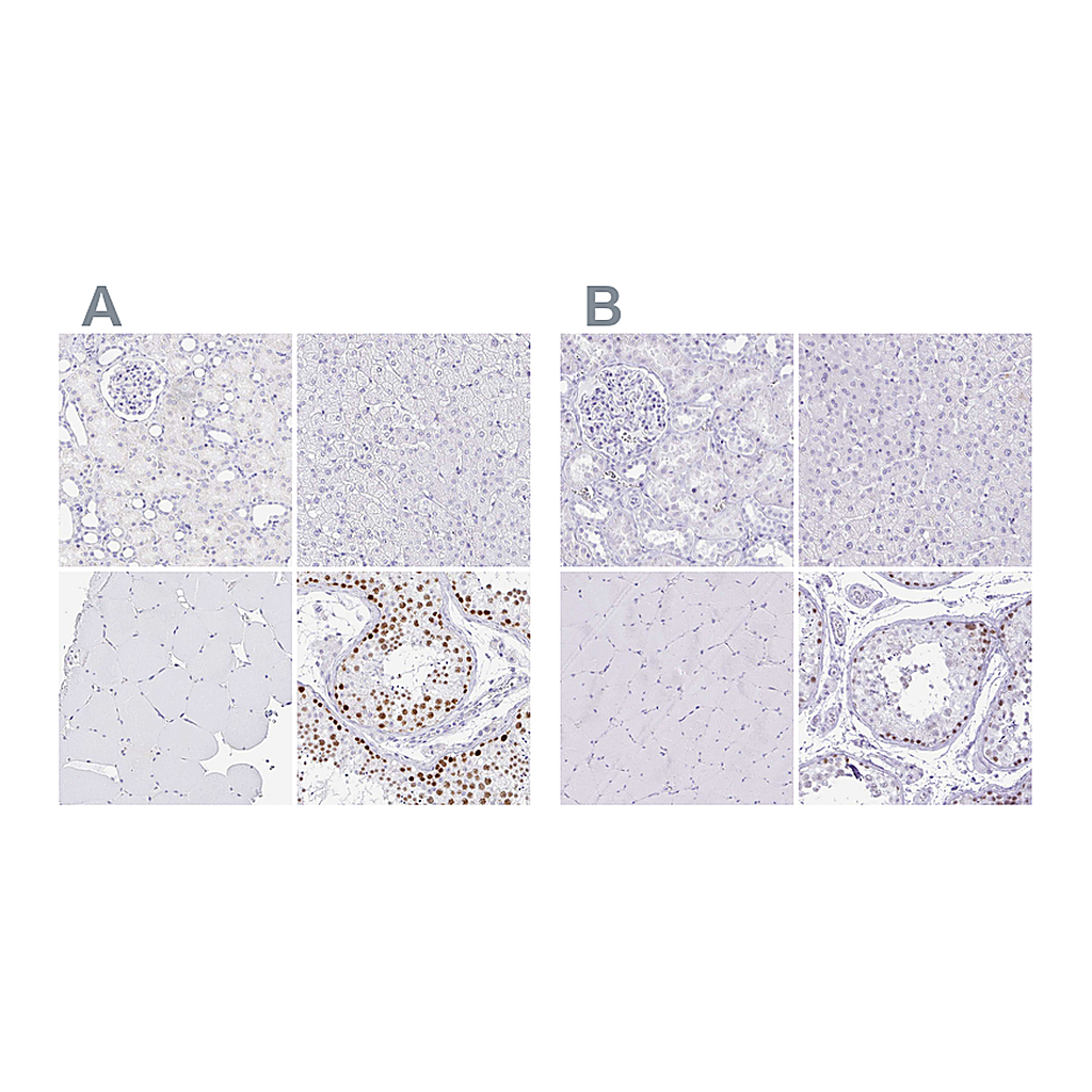 Atlas Antibodies Anti-CXorf67 Antibody