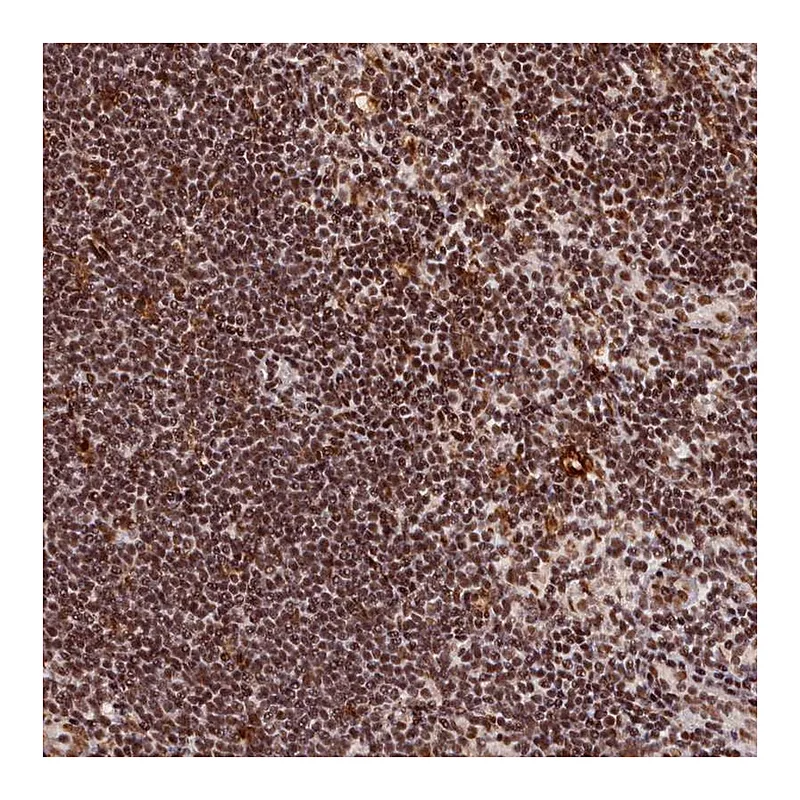 Atlas Antibodies Anti-CXXC1 Antibody