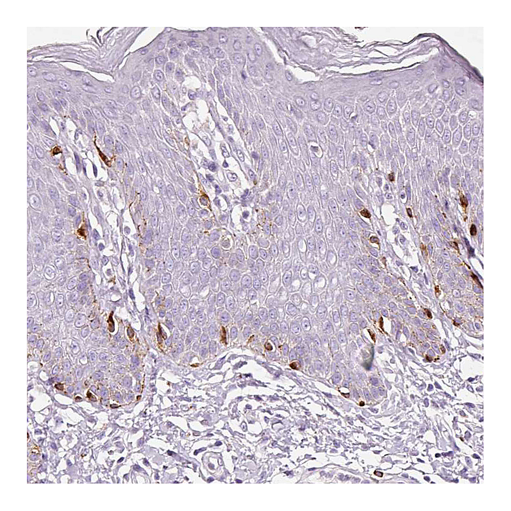 Atlas Antibodies Anti-CYB561A3 Antibody