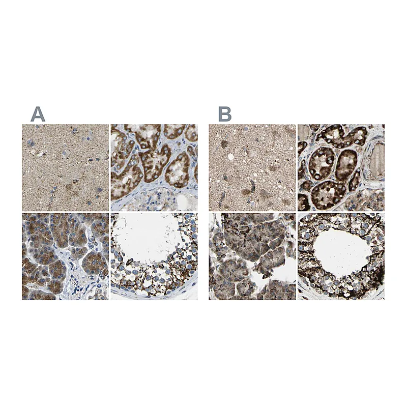 Atlas Antibodies Anti-CYB5R1 Antibody