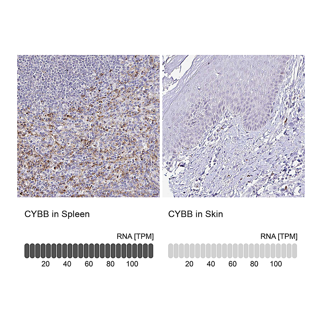 Atlas Antibodies Anti-CYBB Antibody