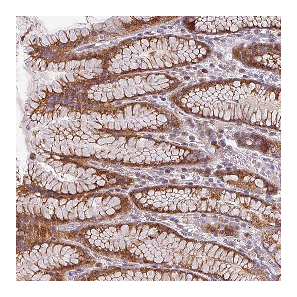 Atlas Antibodies Anti-CYB5RL Antibody