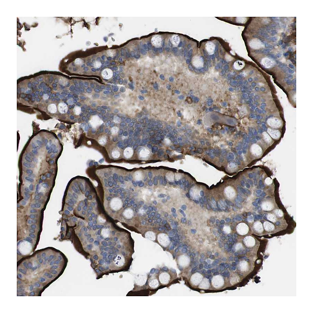 Atlas Antibodies Anti-CYBRD1 Antibody