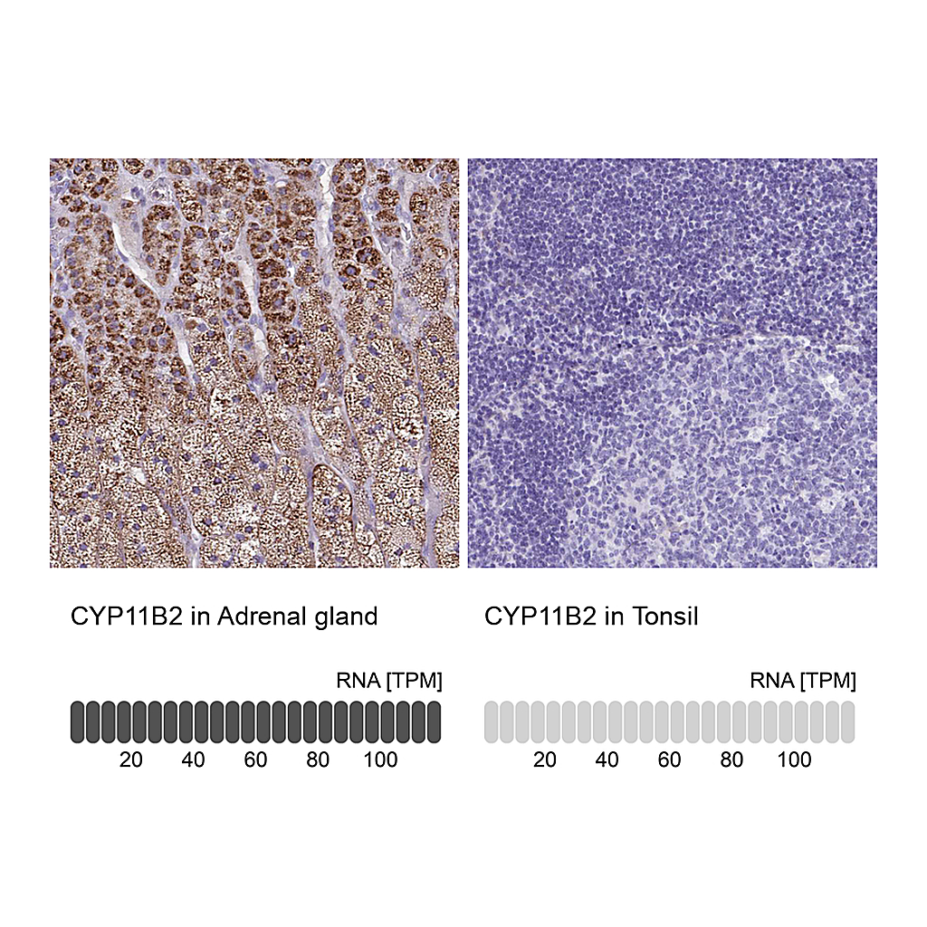 Atlas Antibodies Anti-CYP11B2 Antibody