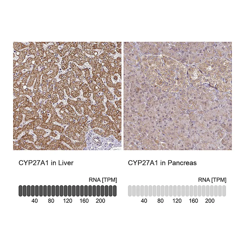 Atlas Antibodies Anti-CYP27A1 Antibody