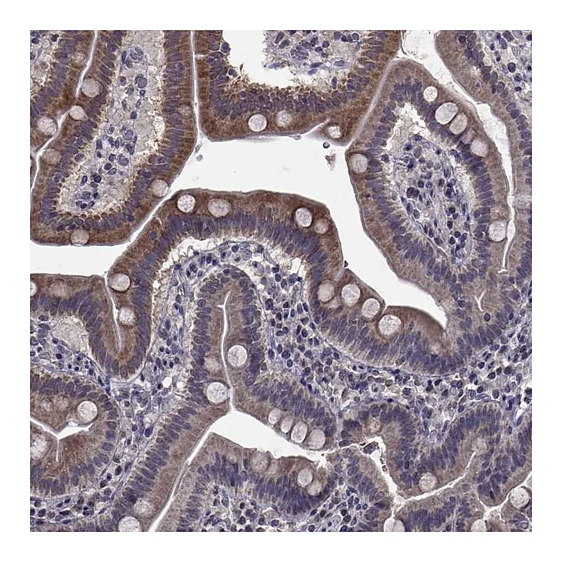 Atlas Antibodies Anti-CYP2S1 Antibody