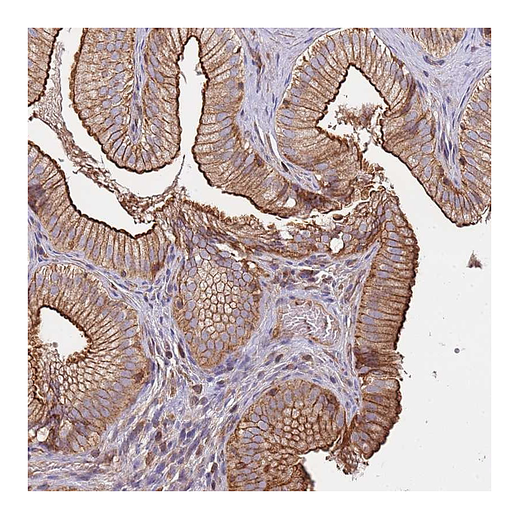 Atlas Antibodies Anti-CYP2U1 Antibody