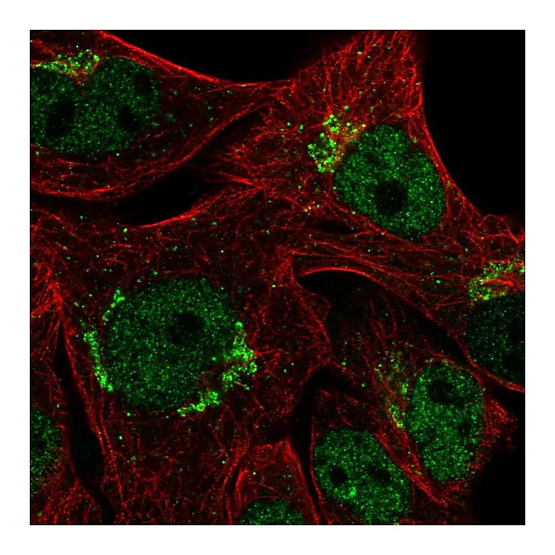 Atlas Antibodies Anti-CYP2U1 Antibody