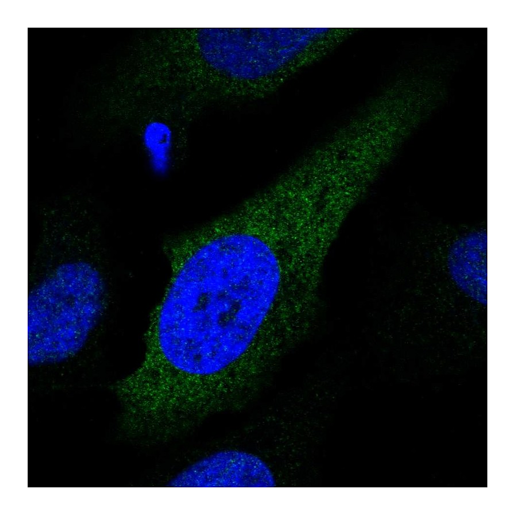 Atlas Antibodies Anti-CYP2S1 Antibody