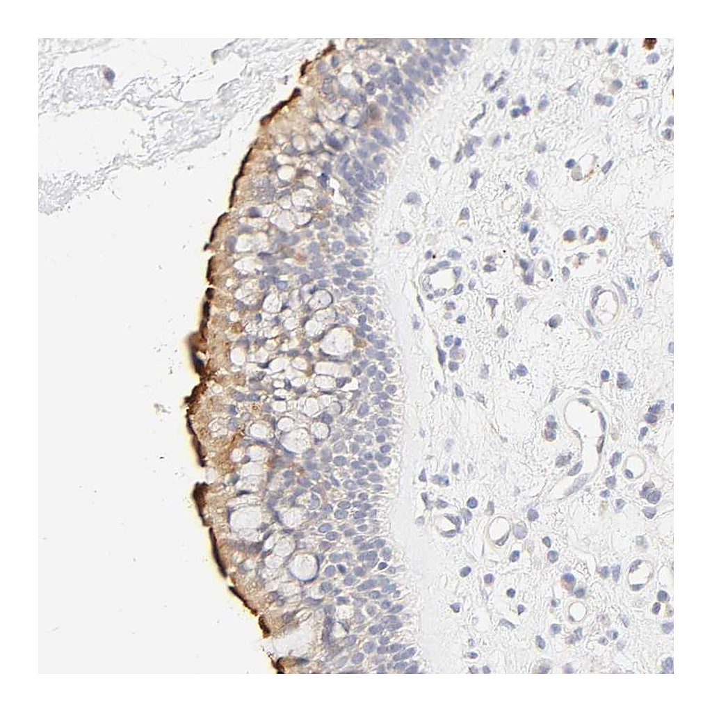 Atlas Antibodies Anti-CYP4B1 Antibody