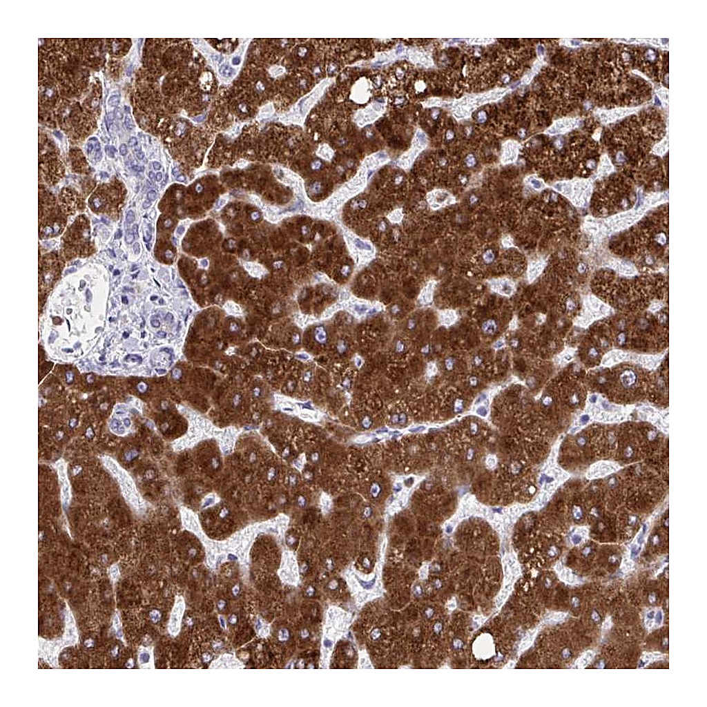 Atlas Antibodies Anti-CYP4F2 Antibody