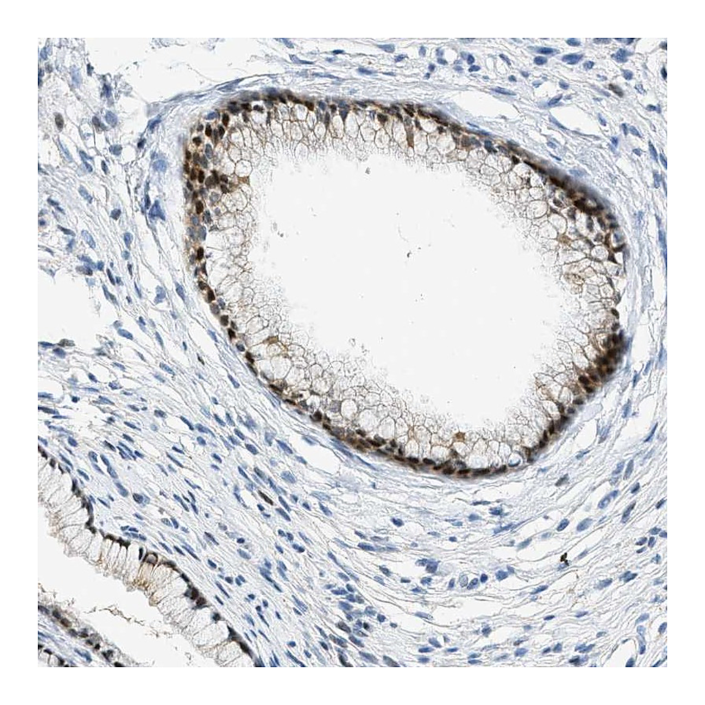 Atlas Antibodies Anti-CYP4X1 Antibody