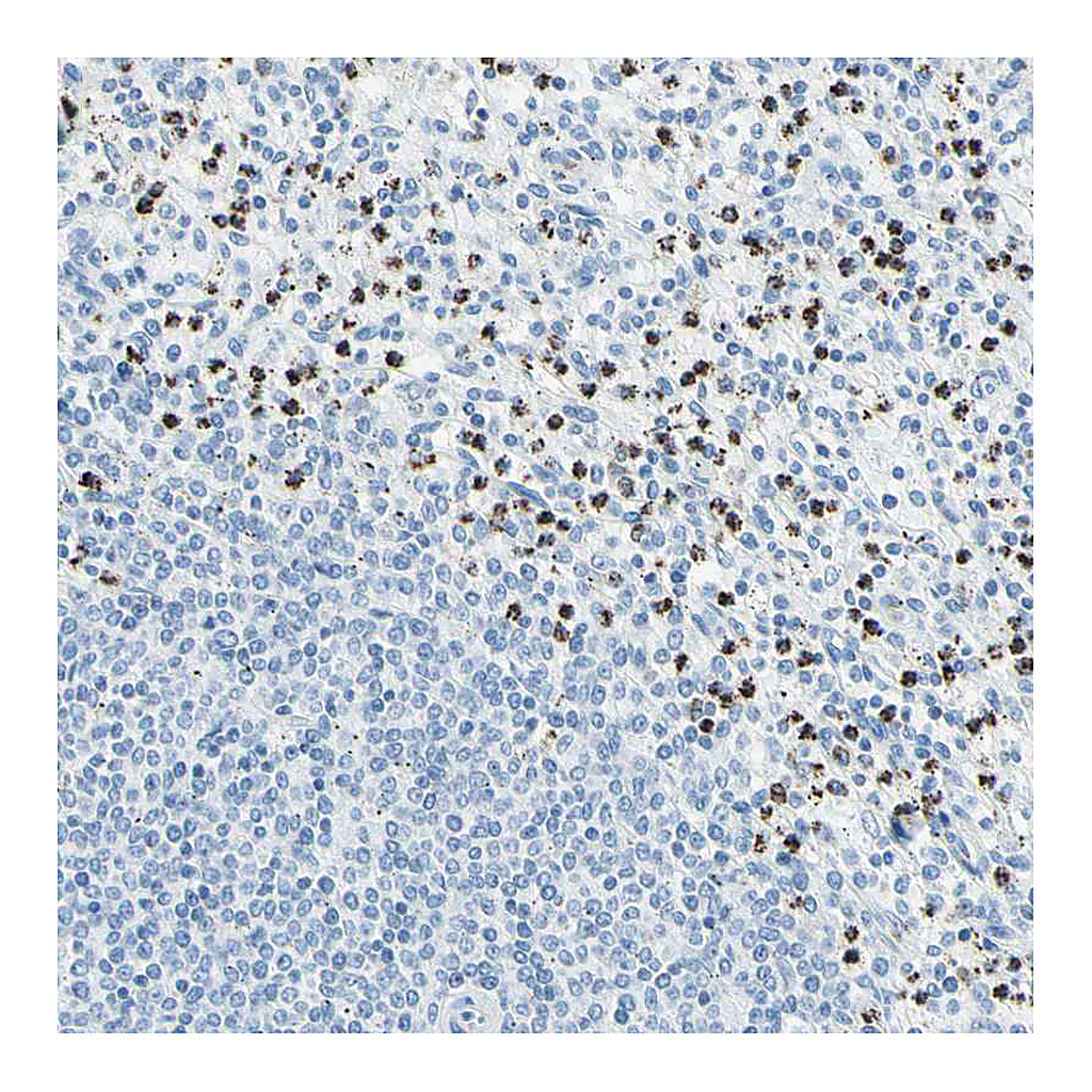 Atlas Antibodies Anti-CYSLTR1 Antibody