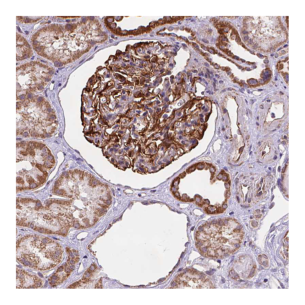 Atlas Antibodies Anti-CYYR1 Antibody