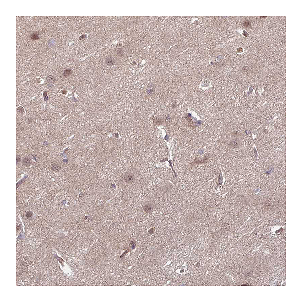 Atlas Antibodies Anti-DAAM2 Antibody