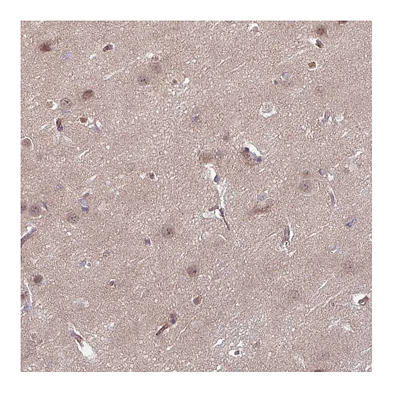 Atlas Antibodies Anti-DAAM2 Antibody