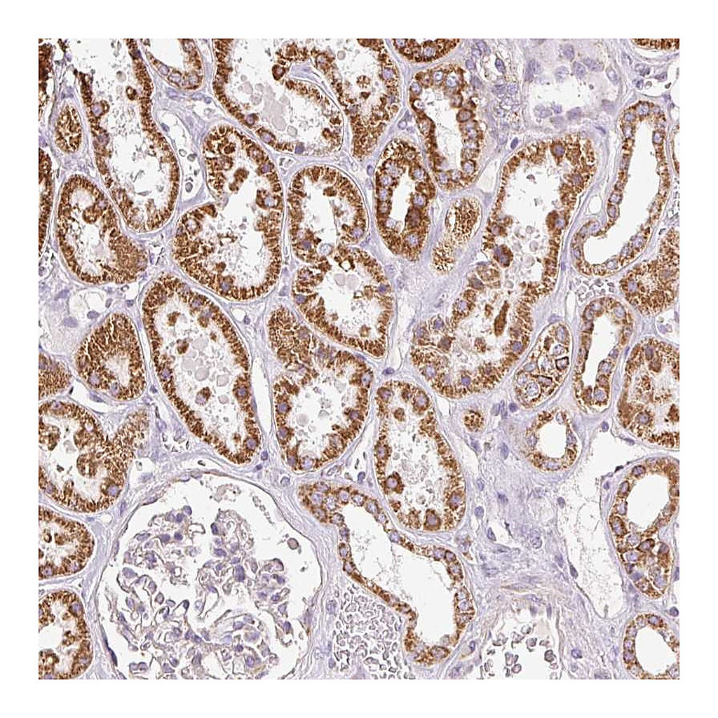 Atlas Antibodies Anti-DAAM2 Antibody