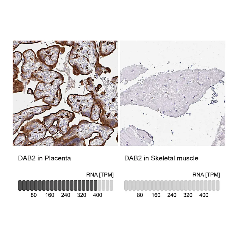 Atlas Antibodies Anti-DAB2 Antibody