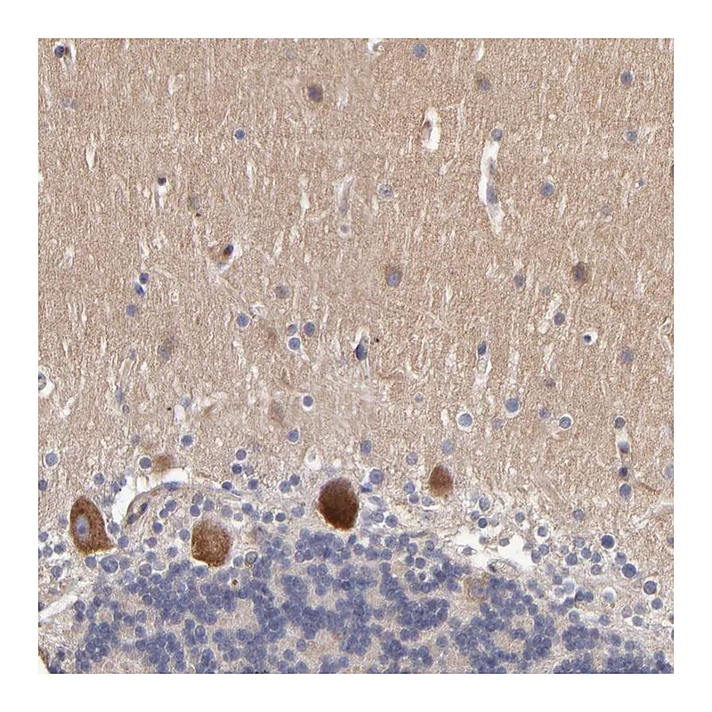 Atlas Antibodies Anti-DACT1 Antibody