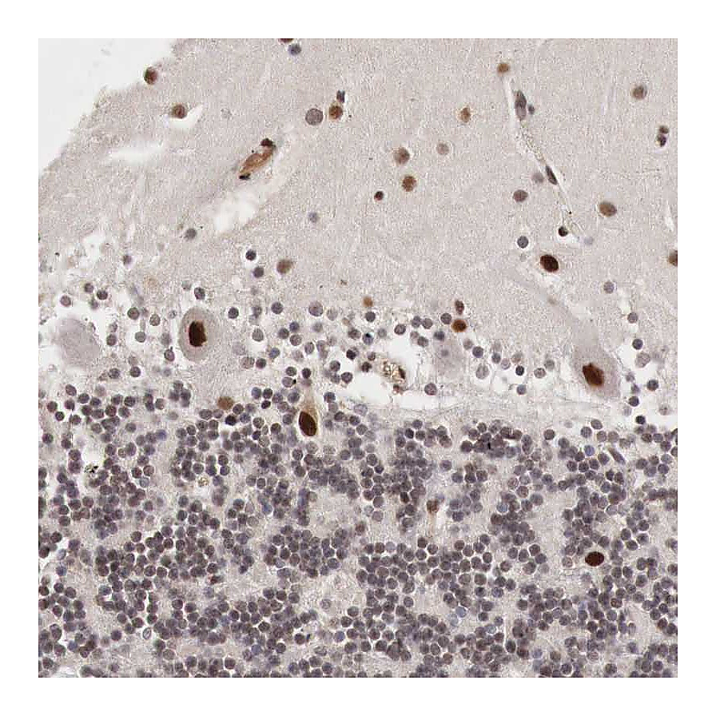 Atlas Antibodies Anti-DACH2 Antibody