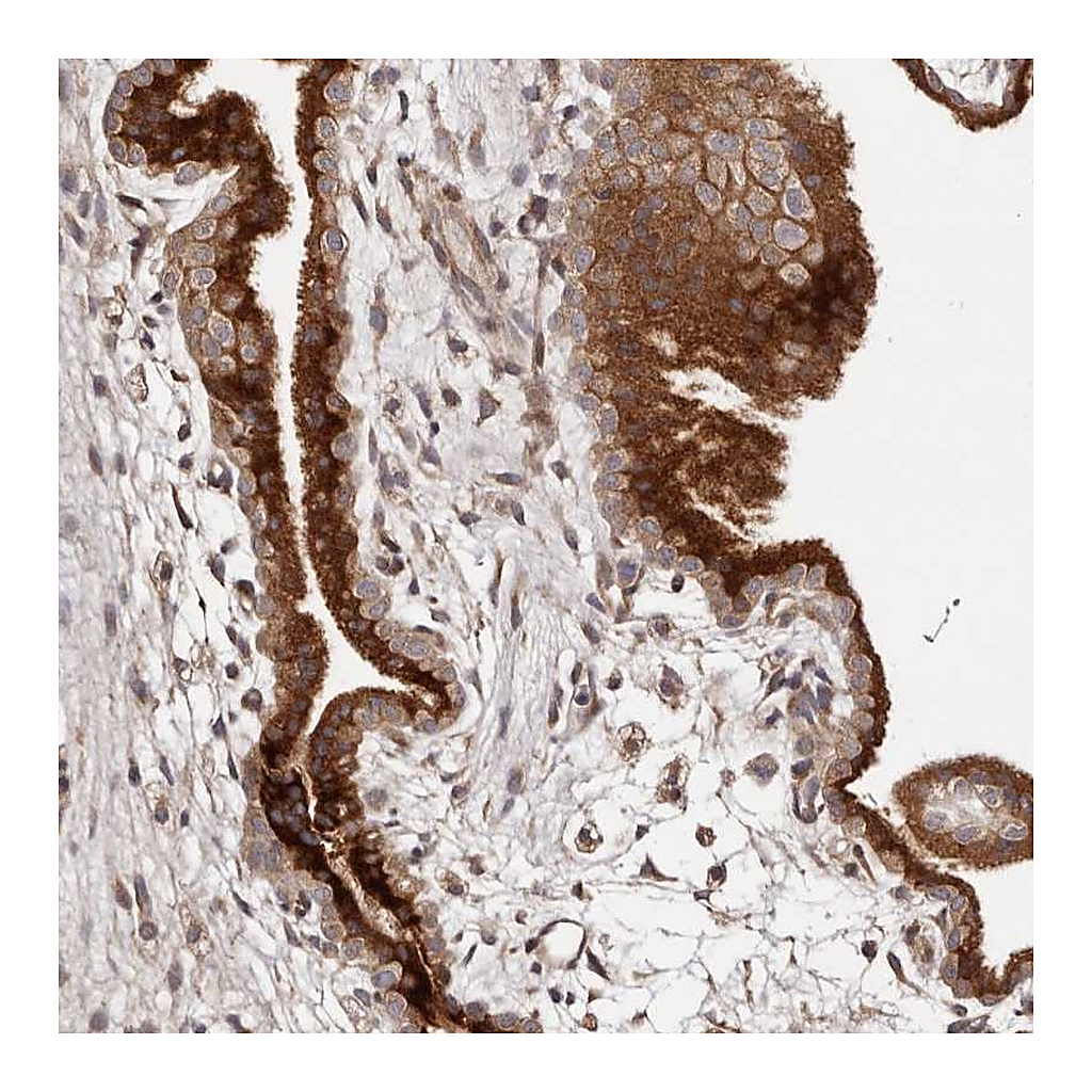 Atlas Antibodies Anti-DACT2 Antibody