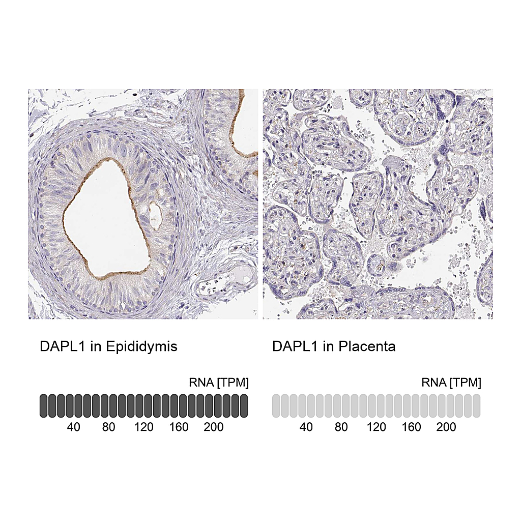 Atlas Antibodies Anti-DAPL1 Antibody
