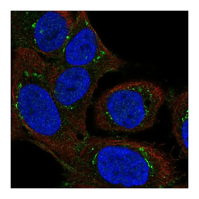 Atlas Antibodies Anti-DAPK2 Antibody
