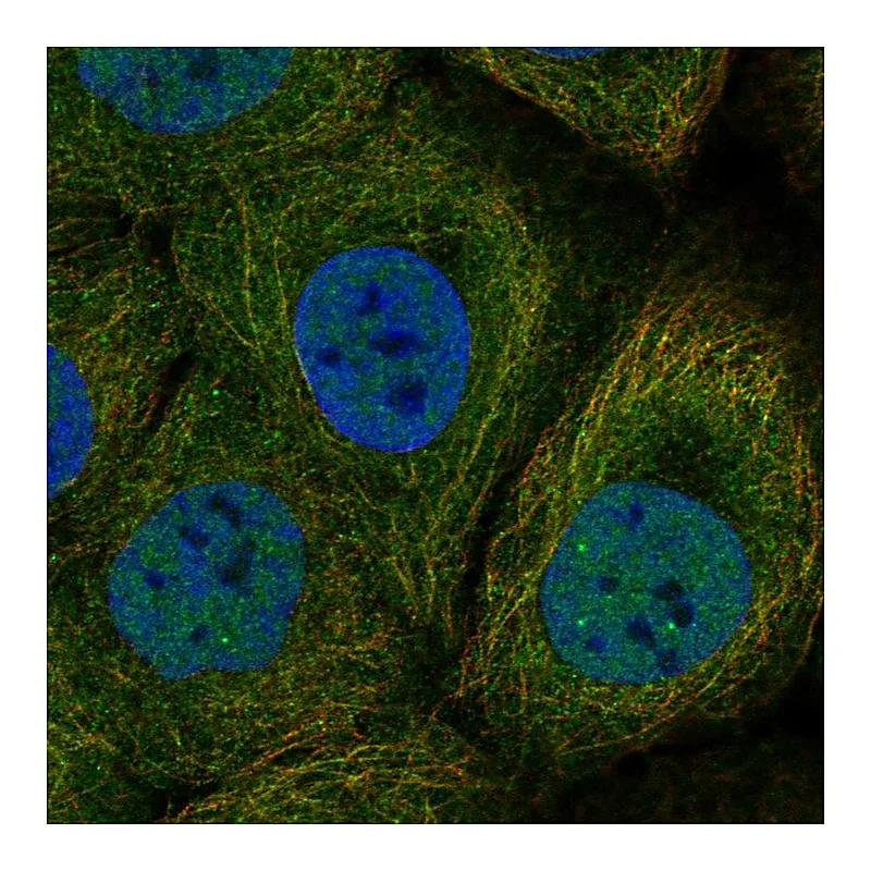 Atlas Antibodies Anti-DAPL1 Antibody