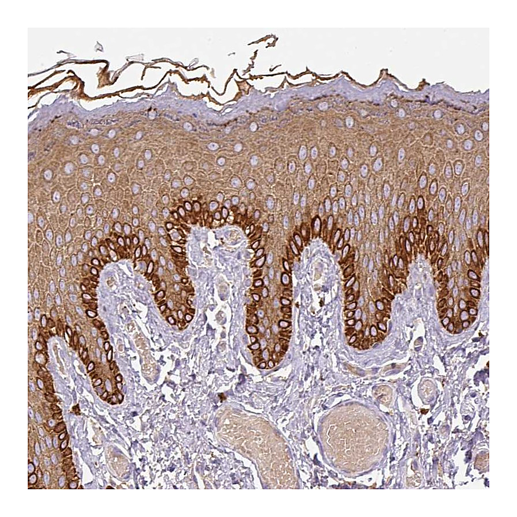 Atlas Antibodies Anti-DAPK1 Antibody
