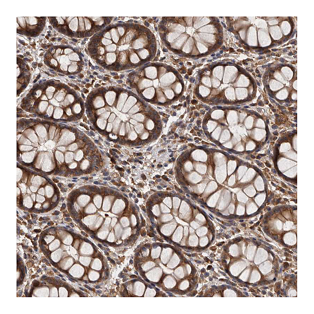 Atlas Antibodies Anti-DARS Antibody